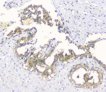 Hyaluronan synthase 1/HAS1 Rabbit Polyclonal Antibody