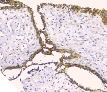 Hyaluronan synthase 1/HAS1 Rabbit Polyclonal Antibody