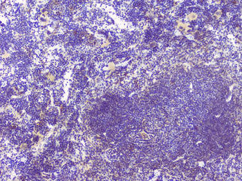 Hyaluronan synthase 1/HAS1 Rabbit Polyclonal Antibody
