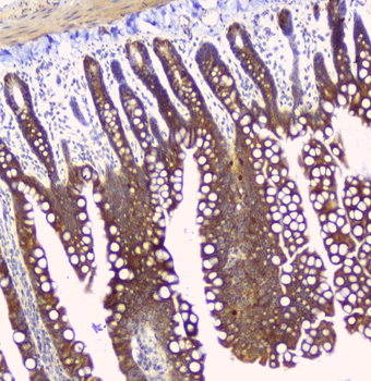 Hyaluronan synthase 1/HAS1 Rabbit Polyclonal Antibody