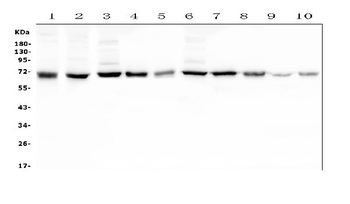 Hyaluronan synthase 1/HAS1 Rabbit Polyclonal Antibody