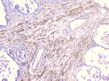 PCDH15 Rabbit Polyclonal Antibody