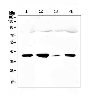 uPA Receptor/PLAUR Rabbit Polyclonal Antibody