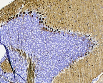 PKC gamma/PRKCG Rabbit Polyclonal Antibody
