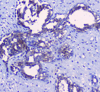 SRI Rabbit Polyclonal Antibody