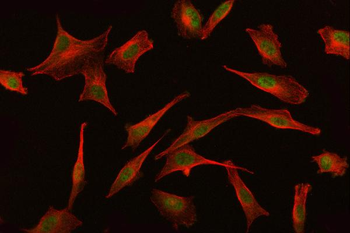 BAT3/BAG6 Rabbit Polyclonal Antibody