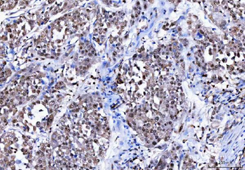 BAT3/BAG6 Rabbit Polyclonal Antibody