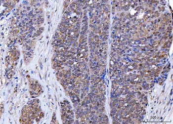 BAT3/BAG6 Rabbit Polyclonal Antibody