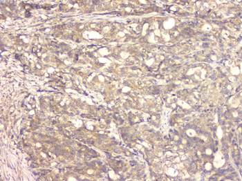 BMP15 Rabbit Polyclonal Antibody