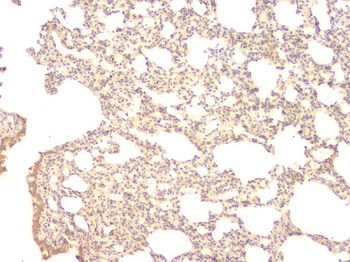 BMP15 Rabbit Polyclonal Antibody