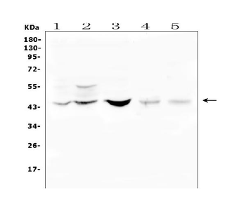 BMP15 Rabbit Polyclonal Antibody