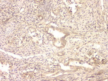 BMP15 Rabbit Polyclonal Antibody
