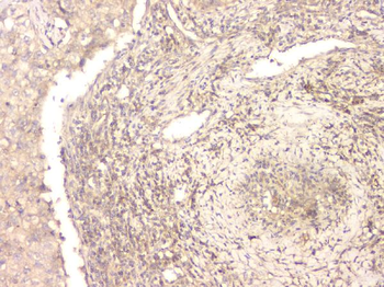 BMP15 Rabbit Polyclonal Antibody