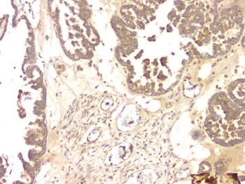 BMP15 Rabbit Polyclonal Antibody