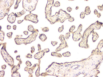 BMP15 Rabbit Polyclonal Antibody