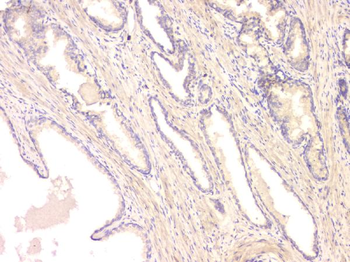 BMP15 Rabbit Polyclonal Antibody