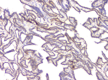 BMP15 Rabbit Polyclonal Antibody