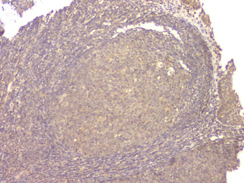 BMP15 Rabbit Polyclonal Antibody