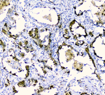CDA Rabbit Polyclonal Antibody