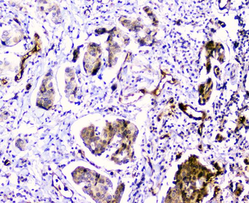 CDA Rabbit Polyclonal Antibody