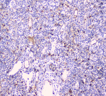 CDA Rabbit Polyclonal Antibody