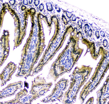 CDA Rabbit Polyclonal Antibody