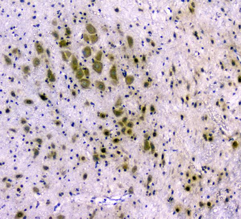 CDA Rabbit Polyclonal Antibody
