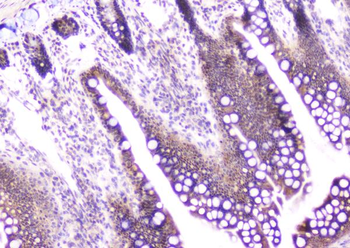 CDA Rabbit Polyclonal Antibody