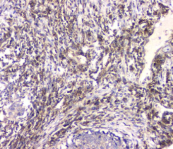 HECTD3 Rabbit Polyclonal Antibody