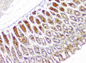 HECTD3 Rabbit Polyclonal Antibody