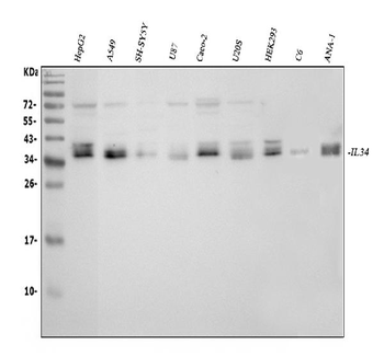 IL34 Rabbit Polyclonal Antibody