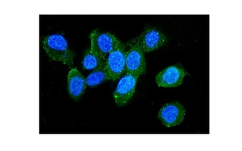 Plastin L/LCP1 Rabbit Polyclonal Antibody