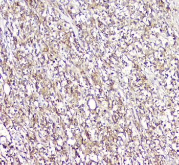 Plastin L/LCP1 Rabbit Polyclonal Antibody