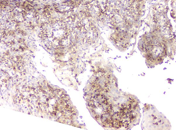Plastin L/LCP1 Rabbit Polyclonal Antibody