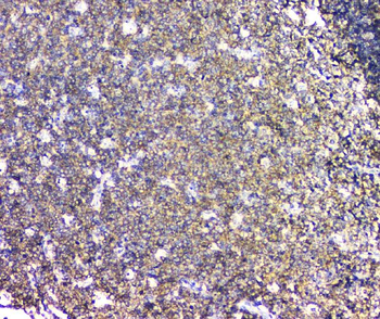 Plastin L/LCP1 Rabbit Polyclonal Antibody