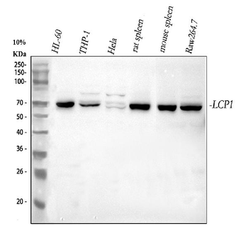 Plastin L/LCP1 Rabbit Polyclonal Antibody