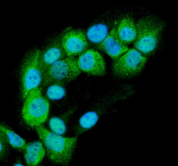 RAB11B Rabbit Polyclonal Antibody