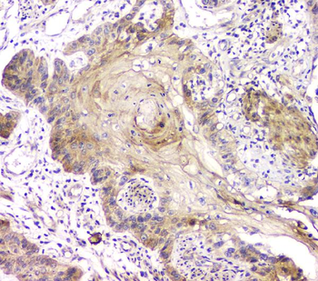 RAB11B Rabbit Polyclonal Antibody