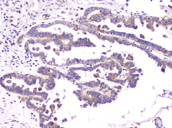 RAB11B Rabbit Polyclonal Antibody