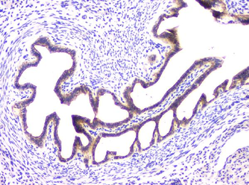 RAB11B Rabbit Polyclonal Antibody
