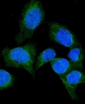 SFRP1 Rabbit Polyclonal Antibody