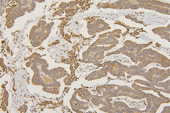 SFRP1 Rabbit Polyclonal Antibody