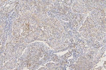 SFRP1 Rabbit Polyclonal Antibody