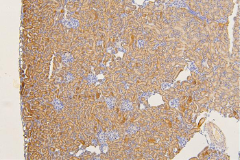 SFRP1 Rabbit Polyclonal Antibody