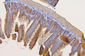 SFRP1 Rabbit Polyclonal Antibody