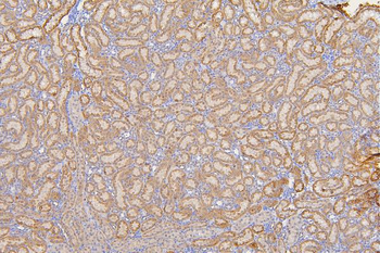 SFRP1 Rabbit Polyclonal Antibody