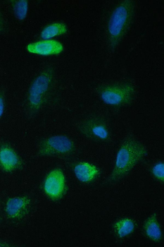 TIMM17A Rabbit Polyclonal Antibody