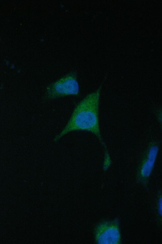 TIMM17A Rabbit Polyclonal Antibody