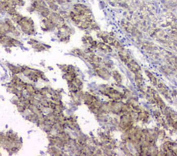 TIMM17A Rabbit Polyclonal Antibody