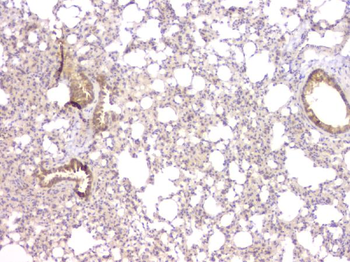 TIMM17A Rabbit Polyclonal Antibody